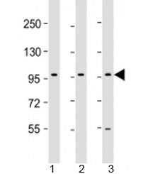 PCDH10 Antibody / Protocadherin 10