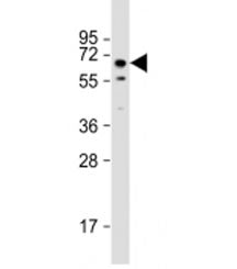 TOR1AIP1 Antibody / Torsin A interacting protein 1