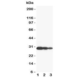 Aquaporin 6 Antibody