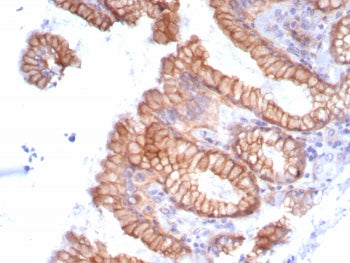 Migfilin-1 Antibody / FBLIM1 / Filamin B