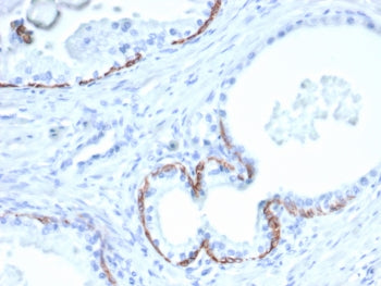IHC staining of FFPE human prostate tissue with CK10 antibody (clone KRT10/6961). HIER: boil tissue