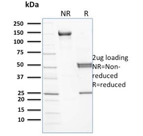 SDS-PAGE analysis of purified, BSA-free SPTB antibody (clone RG/26) as confirmation of integrity and