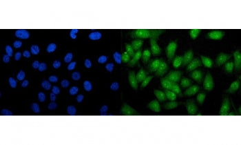RTCA Antibody / RTCD1