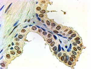 Androgen receptor Antibody