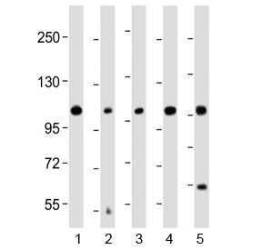 KCNH1 Antibody (C-Terminal Region)