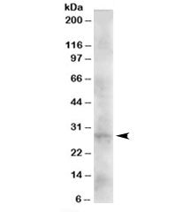 DKK2 Antibody