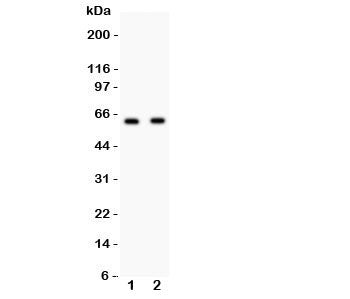 Western blot testing of HEXB antibody and Lane 1: HeLa; 2: HEPG2 lysate. Predicted/observed size ~63