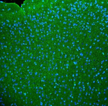 Synaptophysin Antibody