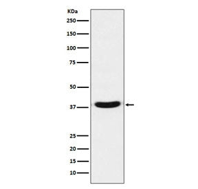 VPS26A Antibody
