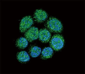 BTK Antibody