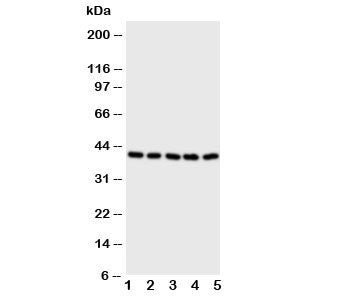Western blot testing of BCAT2 antibody and Lane 1: A431; 2: SW620; 3: SMMC-7721; 4: Jurkat; 5: CEM cell lysate