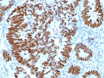 p53 Antibody / TP53