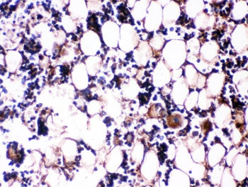 Osteocalcin Antibody