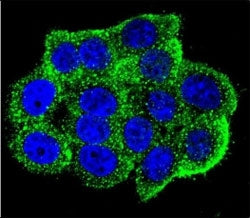 Hamartin Antibody (TSC1)