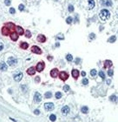 Cyclin D1 Antibody / CCND1, 0.4ml