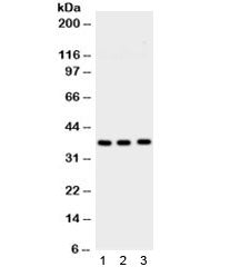 Western blot testing of 1) rat brain, 2) mouse brain and 3) human U87 lysate with Syntaxin 1a antibo