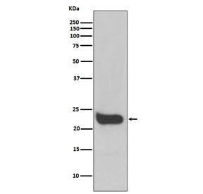 Interferon beta Antibody / IFNB1