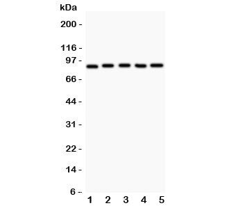 Western blot testing of HIF-1 beta antibody and Lane 1: HeLa; 2: 293T; 3: Jurkat; 4: U87; Lane5: COL