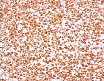 IHC testing of FFPE human tonsil with OCT-2 antibody (clone PD2F2-1). HIER: boil tissue sections in