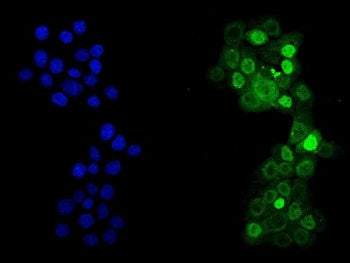 Immunofluorescent staining of FFPE human A431 cells with p53 antibody (green) and DAPI nuclear stain