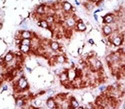 CPT1B Antibody
