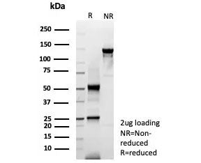 SDS-PAGE analysis of purified, BSA-free KRT6A antibody (clone rKRT6/9402) as confirmation of integri