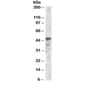 Western blot testing of K562 lysate with IRF8 antibody at 1ug/ml. Predicted molecular weight ~48 kDa