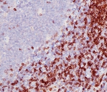 CD5 Antibody