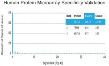Cytokeratin 14 Antibody / CK14 / KRT14