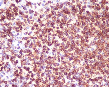 CD45 Antibody / PTPRC