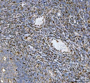 IHC staining of FFPE human tonsil tissue with Heat shock factor protein 1 antibody. HIER: boil tissu