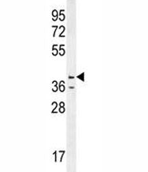 Caspase-12 Antibody, 0.4ml