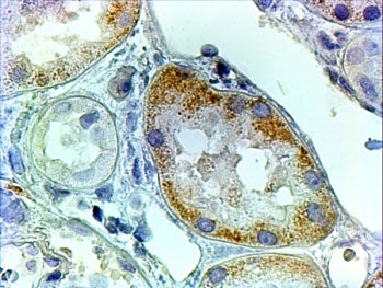 AADAT Antibody
