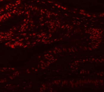 MBNL1 Antibody / Muscleblind-like 1