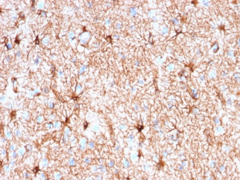 GFAP Antibody / Glial Fibrillary Acidic Protein