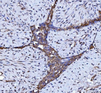Beclin 1 Antibody