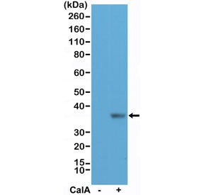 Western blot testing of lysate from human HeLa cells, untreated (-) or treated (+) with Calyculin A