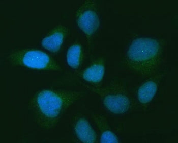 Immunofluorescent staining of FFPE human HeLa cells with Ubiquitin carboxyl-terminal hydrolase 16 an