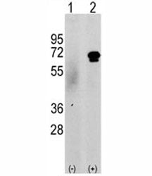 CAMKK2 Antibody