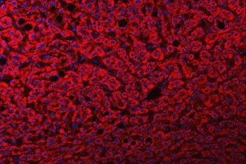 FRY Antibody / Protein furry homolog