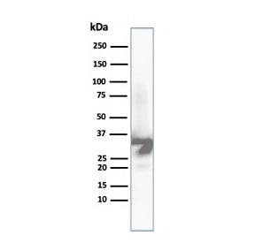 Arginase 1 Antibody