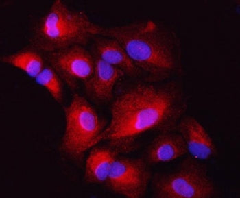 ZIP7 Antibody / HKE4 / SLC39A7
