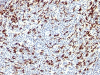 PDCD1 Antibody / PD-1 / PD1