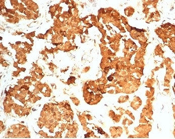 HCG-beta Antibody
