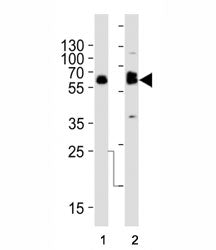 TH Antibody