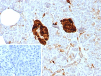 NSE Antibody / Neuron Specific Enolase