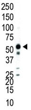 JNK2 Antibody (MAPK9)