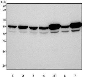 Western blot testing of 1) human Jurkat, 2) human SH-SY5Y, 3) human U-87 MG, 4) human U-251, 5) rat