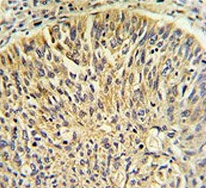 TCP1 gamma Antibody / CCT3