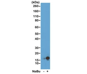 H3K9ac Antibody / Acetyl Histone H3 Lysine 9
